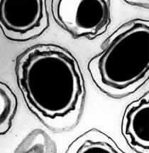 Anthrax Scare Shuts 11 Washington Postal Buildings